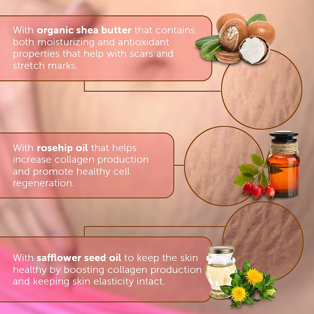 Belly Butter for Pregnancy & Stretch Mark Care