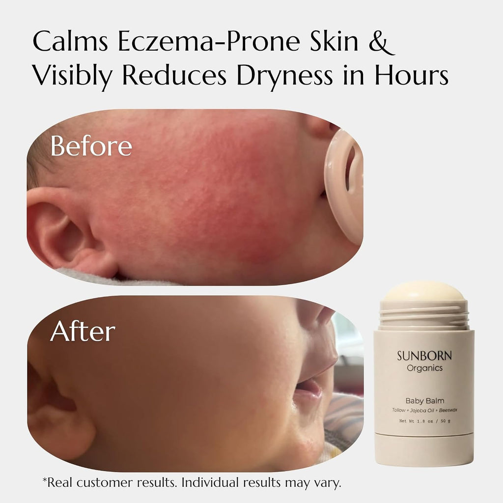 Baby Balm Moisturizing Stick for Sensitive Skin & Diaper Care
